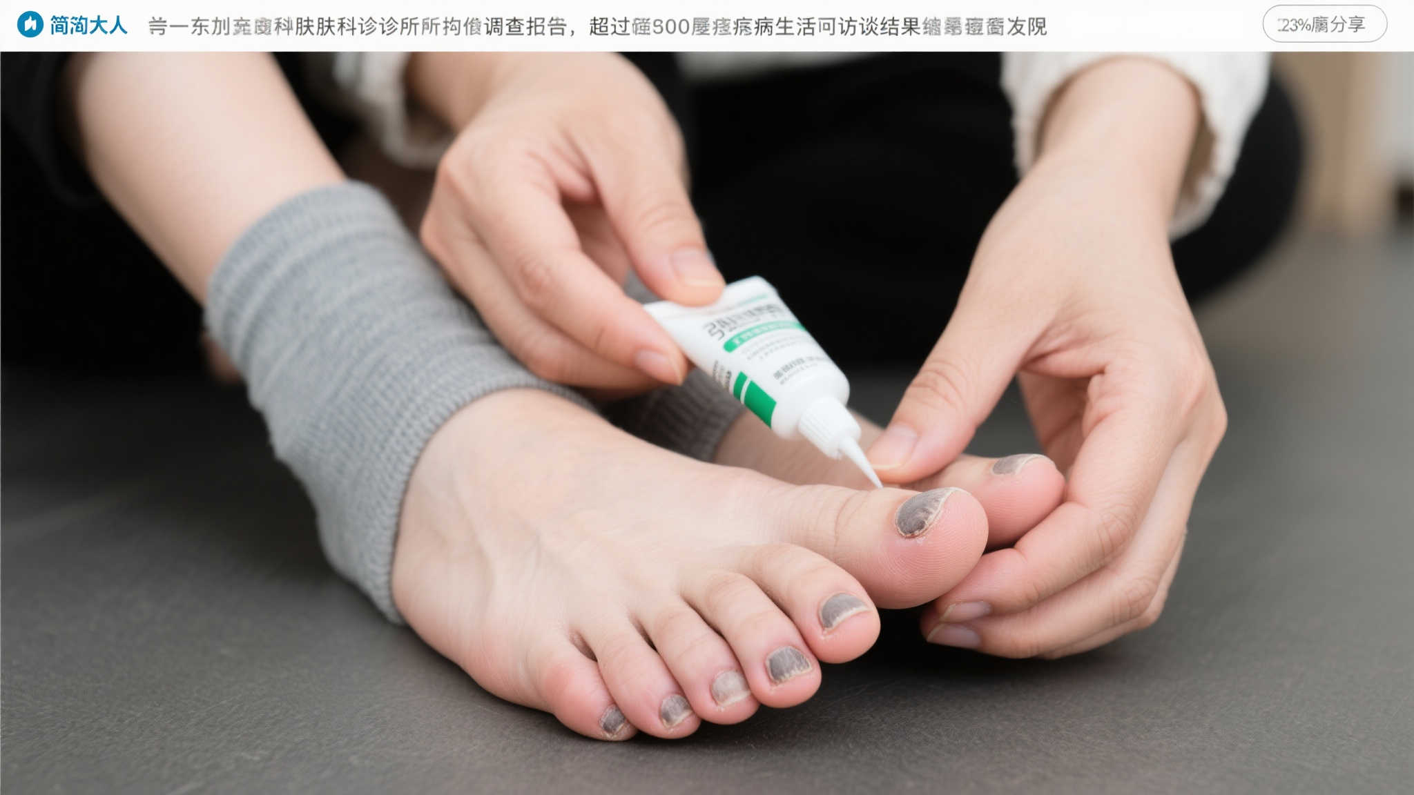 洞洞鞋或成真菌感染温床,引发微博热议 洞洞鞋或成真菌感染温床,引发微博热议